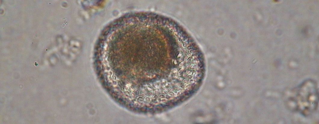 Wurmei in der mikroskopischen Untersuchung